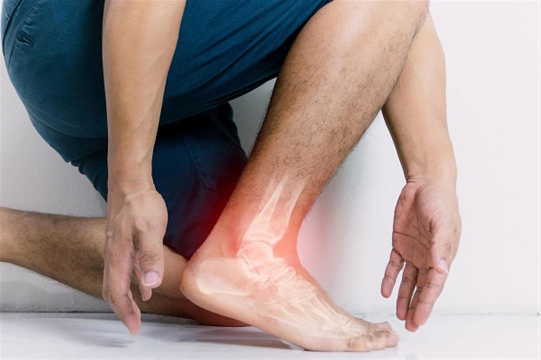 علامات انسداد الشرايين- أعراض تظهر على القدمين