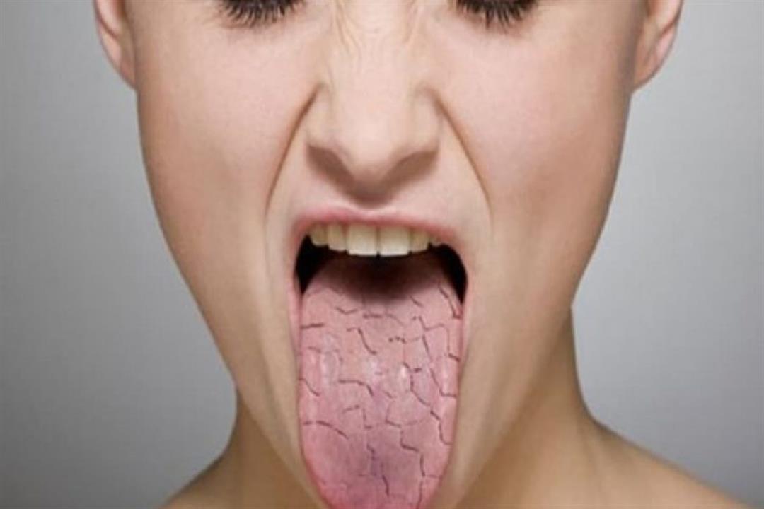 أدوية تسبب جفاف الفم والحلق